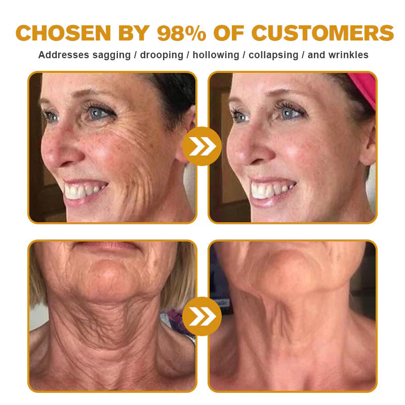 👨⚕️ Made and Shipped from US✅ Botox Bee Venom Wrinkle Removal Cream- LAST DAY 80% OFF