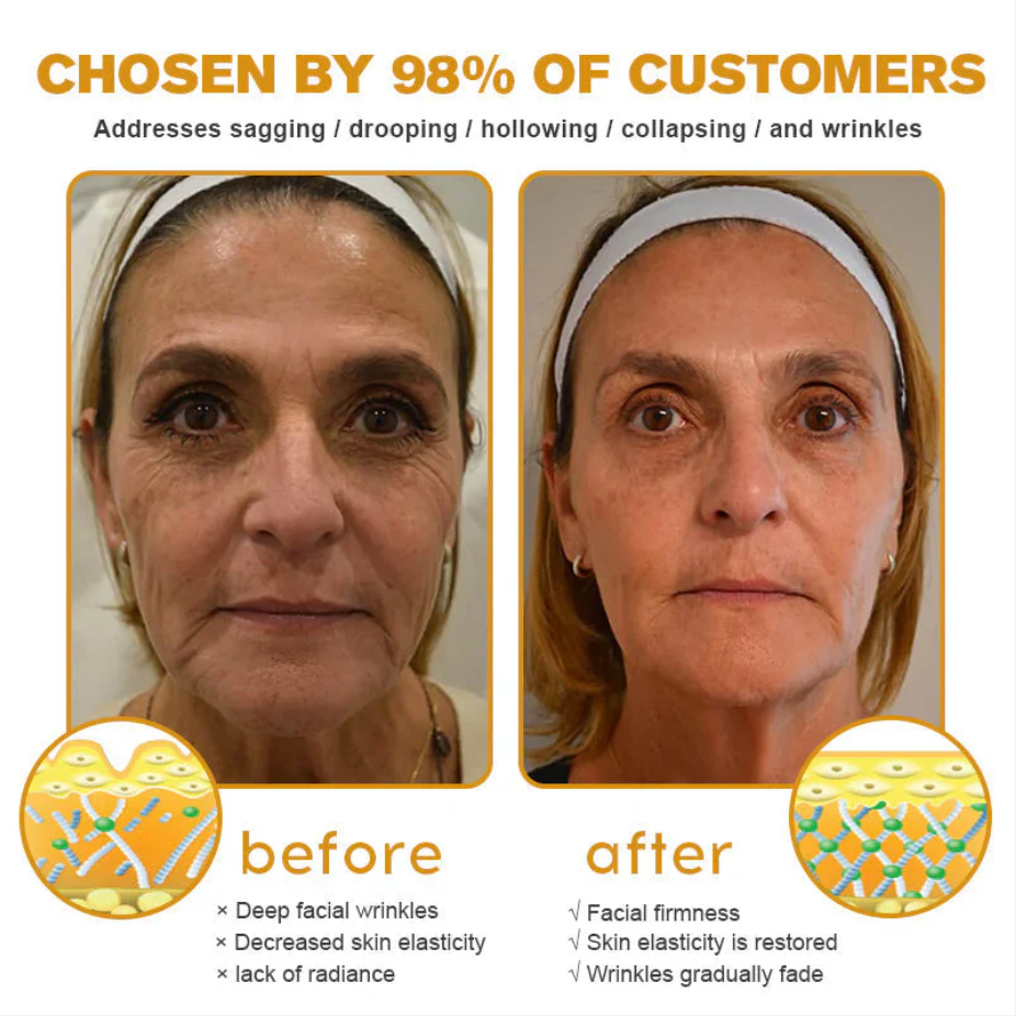 👨‍⚕️ Made and Shipped from US✅ Botox Bee Venom Wrinkle Removal Cream- LAST DAY 80% OFF