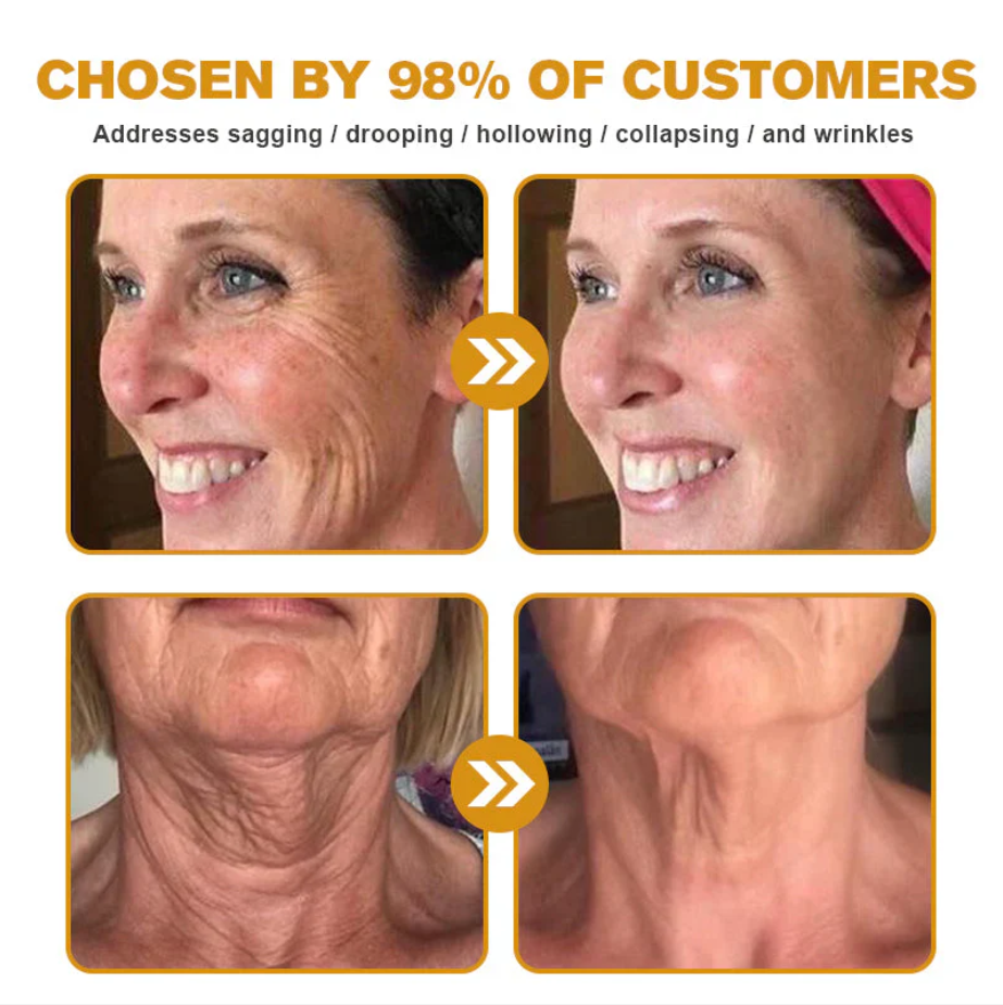 👨‍⚕️ Made and Shipped from US✅ Botox Bee Venom Wrinkle Removal Cream- LAST DAY 80% OFF