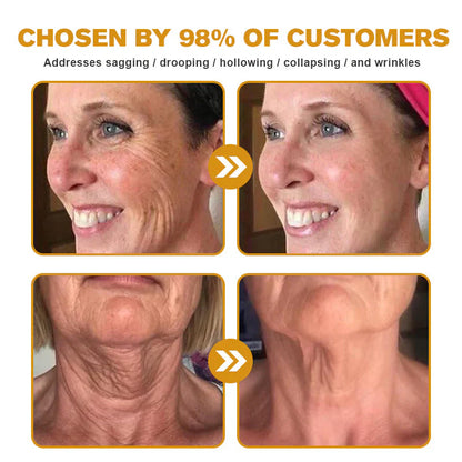 👨‍⚕️ Made and Shipped from US✅  Botox Bee Venom Wrinkle Removal Cream- LAST DAY 80% OFF