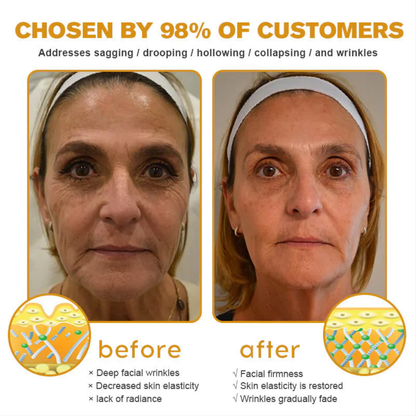 👨‍⚕️ Made and Shipped from US✅  Botox Bee Venom Wrinkle Removal Cream- LAST DAY 80% OFF