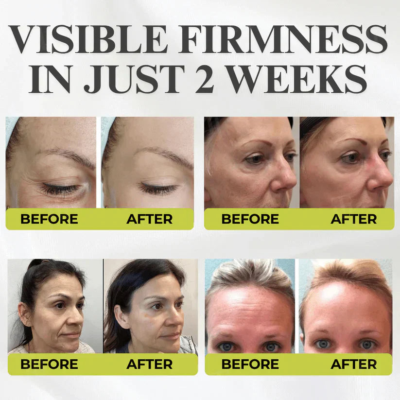 🌿 💫Tiworld® Botox & Vita-A Retinol Shot Wrinkle-Lift Tightening cream - Last Day Promotion 70% OFF