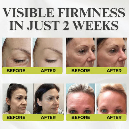 🌿 💫Tiworld® Botox & Vita-A Retinol Shot Wrinkle-Lift Tightening cream - Last Day Promotion 70% OFF