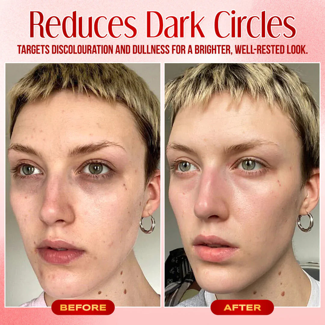 🔥Last Day Promotion!⭐Instant Eye Bag Eraser: Visibly Lift & Smooth in Seconds