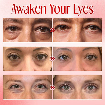 🔥Last Day Promotion!⭐Instant Eye Bag Eraser: Visibly Lift & Smooth in Seconds