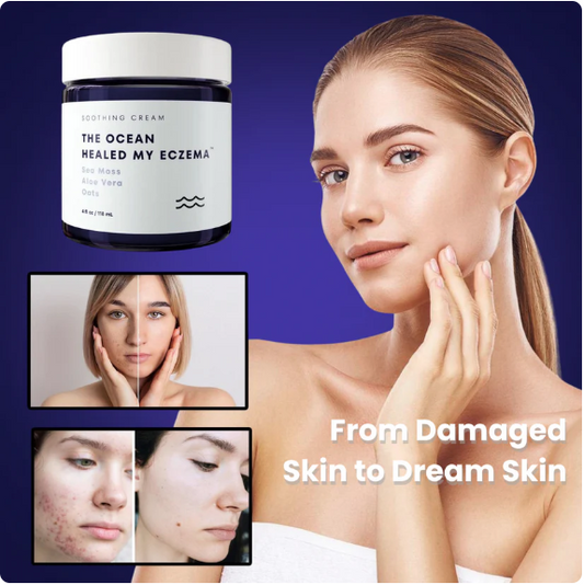 Eczema™ - Stop suffering from irritations or burns
