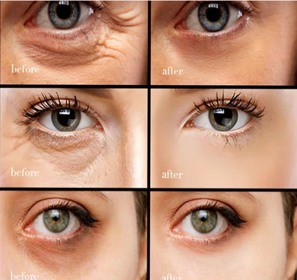 【Black Friday,50 %off,】Caffeine eye cream